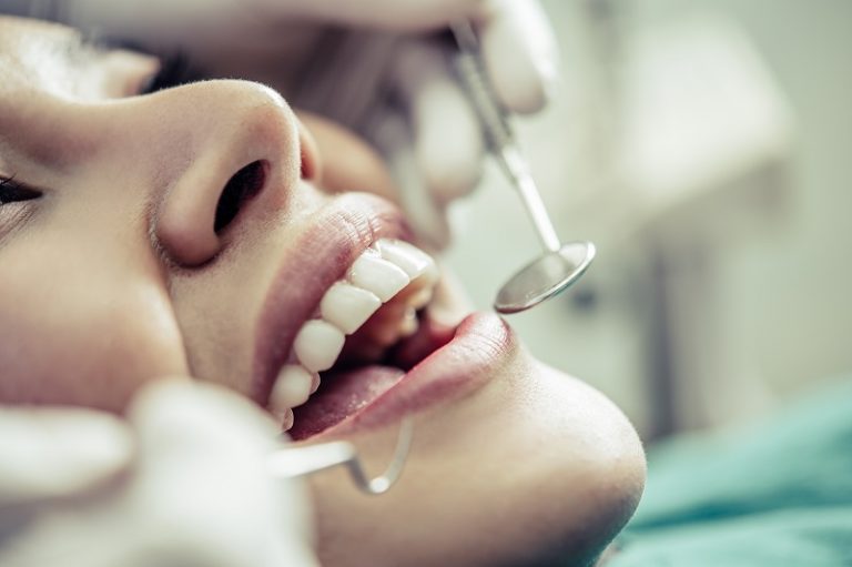 implant dentar pret 2
