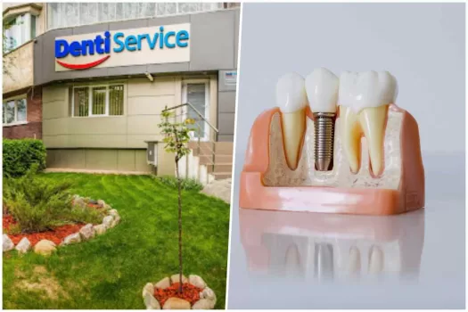 denti service
