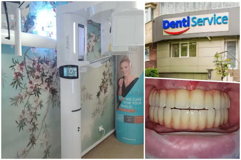 denti 1